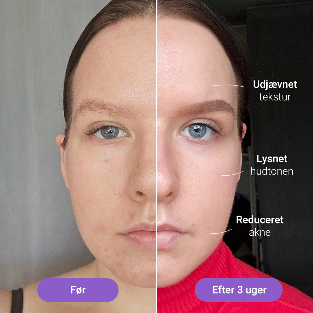 Lumi lysterapimaske