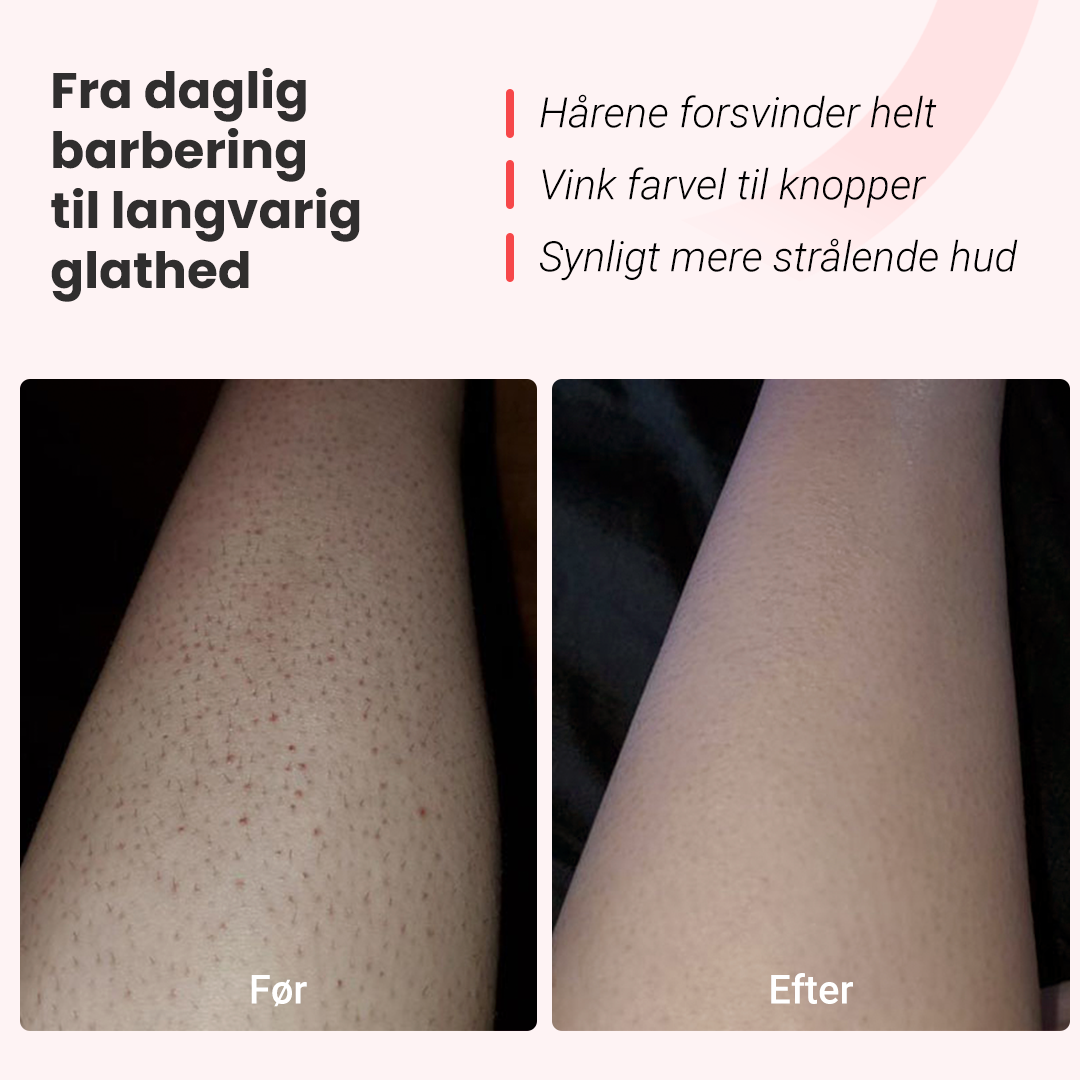 Hårfjerningssæt Hilda IPL Quartz